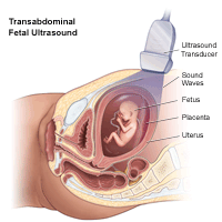Transabnaminal胎儿超声的插图