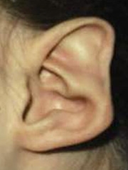斯塔尔的耳朵形象